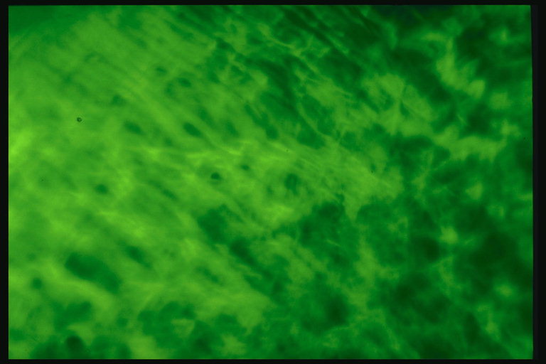 Тона с зелёным цветом абстрактной структуры
