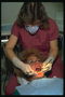 Dentist. Vaatlus patsiendi