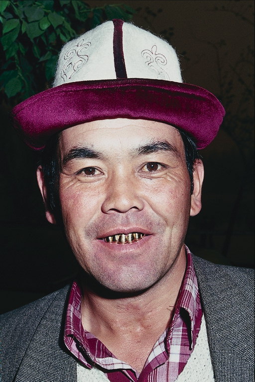 Мужчина с золотыми зубами
